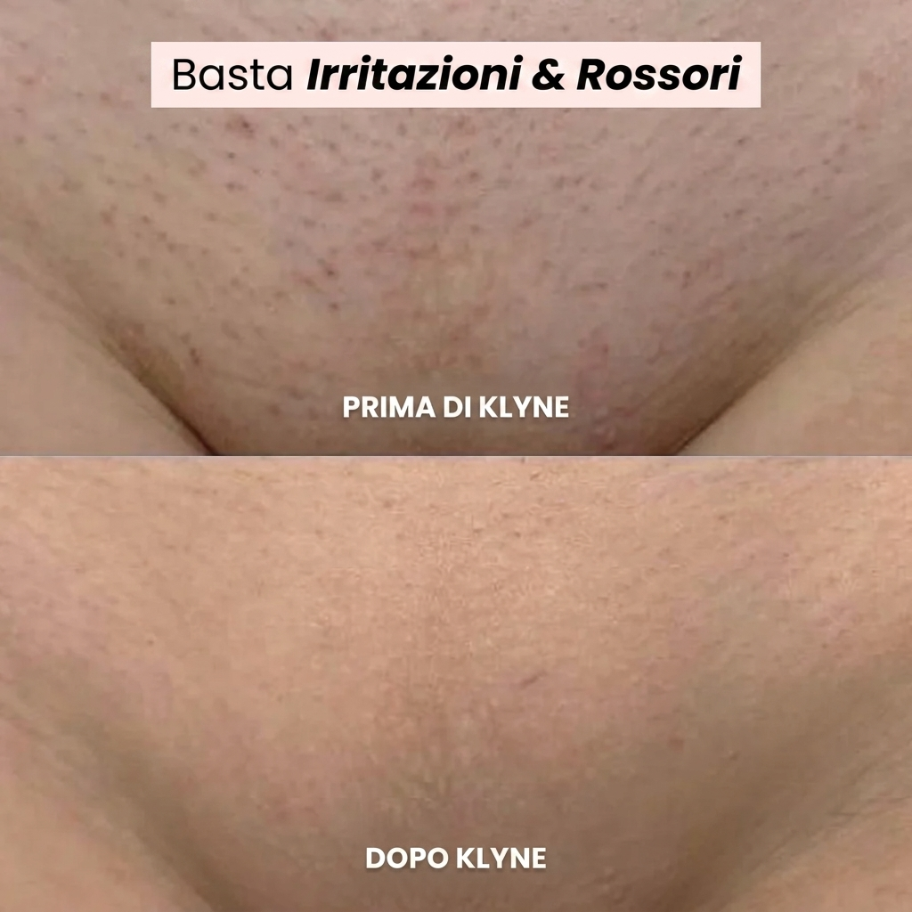 Rasoio Femvita®