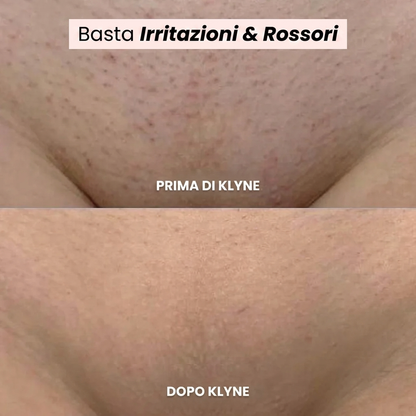 Rasoio Femvita®